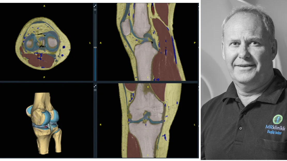 A Alesund startup nominert til gjev pris