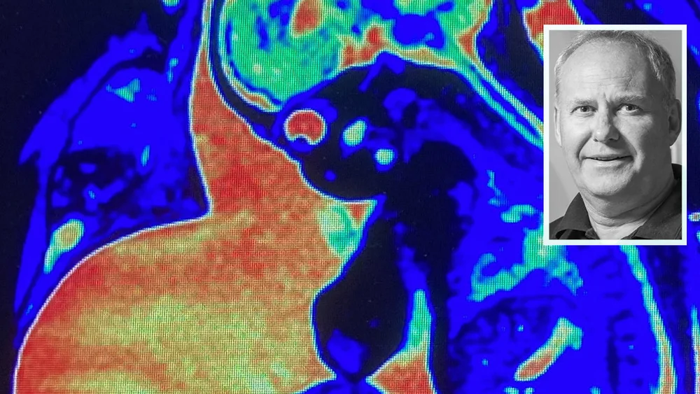 Nordiccad innfelt kjell inge gjesdal baby segmentation tool fto nordiccad 11